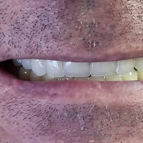 ODONTOLOGIA & LABORATORIO DENTAL OYARZUN - Dentista