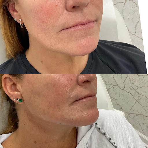 Explore tattoo ideas for women arm, creative tattoo ideas in Owensboro, available at The Skin Lab