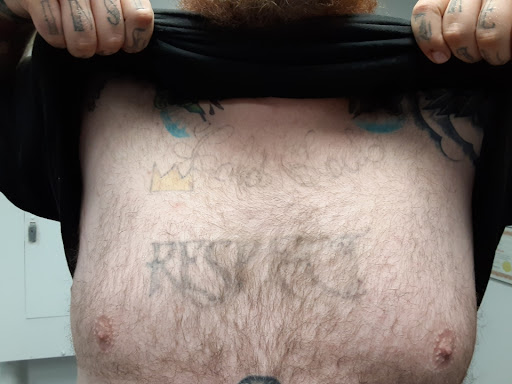 Explore minato tattoo ideas, creative tattoo ideas in Saint Paul, available at Fearless Tattoo Removal