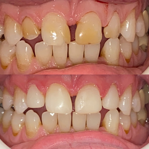 Lagemann Family Dentistry Quality Family & Cosmetic Dentist in Mountain View image
