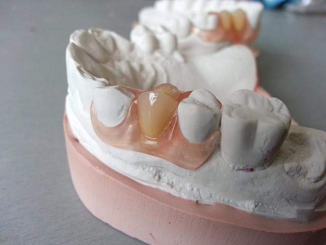 Reparación de prótesis dental a domicilio - Laboratorio