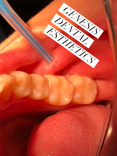 Genesis Dental Esthetics