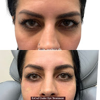 Rain Aesthetics Medspa - Photo 8 - Car repair in Surprise, AZ, Surprise