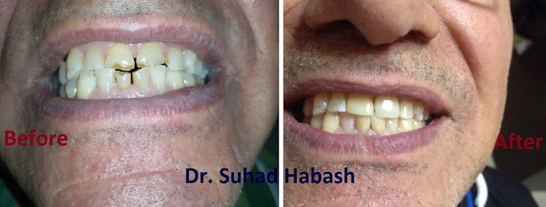 Dr Suhad Habash Dental Clinic - Dr Suhad Habash Dental Clinic