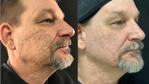 Explore tattoo ideas feet, creative tattoo ideas in Brookfield, available at Milwaukee Laser & Body Aesthetics