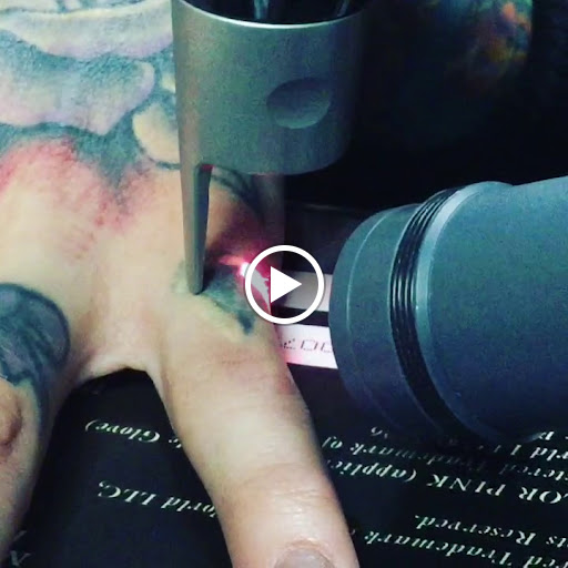 Explore kill bill tattoo ideas, creative tattoo ideas in Vienna, available at Removery Tattoo Removal & Fading