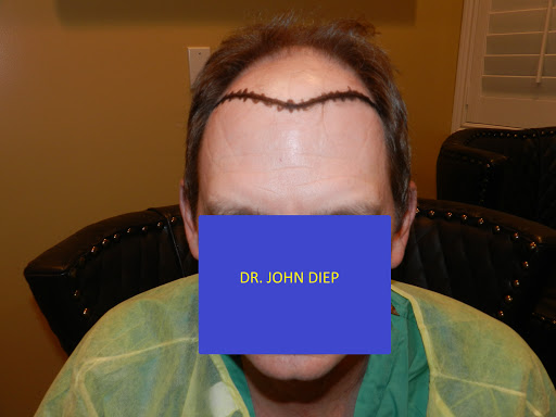 Hair Replacement Service «Medical Hair Transplant & Aesthetics», reviews and photos, 490 Post St #1701, San Francisco, CA 94102, USA