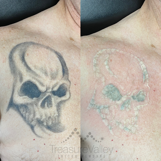 Explore 3 sons tattoo ideas for dad, creative tattoo ideas in Boise, available at Treasure Valley Tattoo Removal