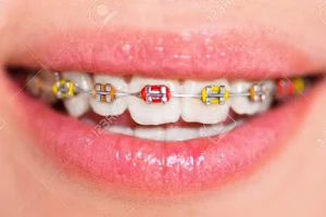 The Dental Avenue ( Dr Manshad Ali ) image