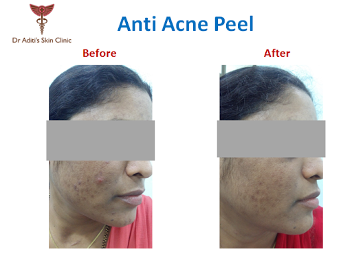 Dr Aditi's Skin Clinic