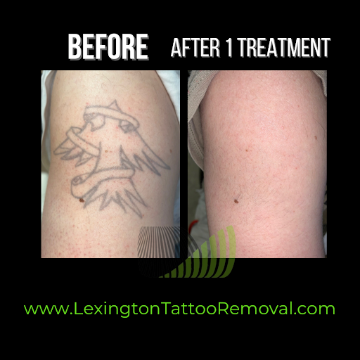 Explore snook tattoo ideas, creative tattoo ideas in Lexington, available at Lexington Tattoo Removal