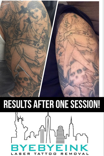 Explore danny phantom tattoo ideas, creative tattoo ideas in Middle Village, available at Bye Bye Ink Laser Tattoo Removal