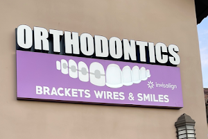 Brackets Wires and Smiles image