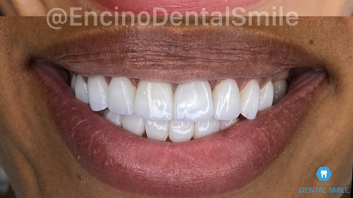 Encino Dental Smile image