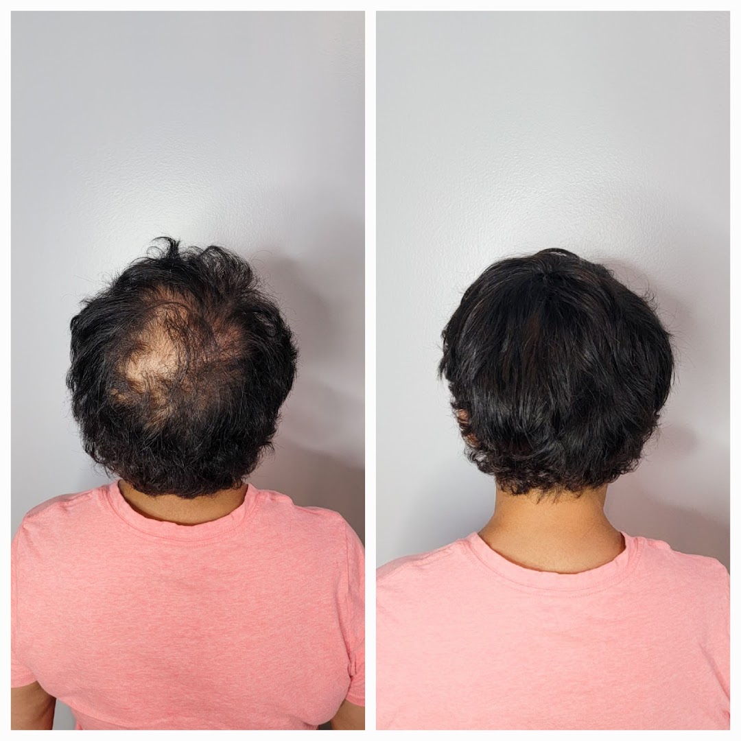 Trichologist | Hair loss | Hair replacement | Wig specialist