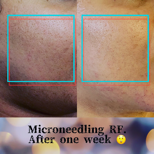 Day Spa «Laser Tysons Paramedical Spa», reviews and photos, 7649 Leesburg Pike a, Falls Church, VA 22043, USA