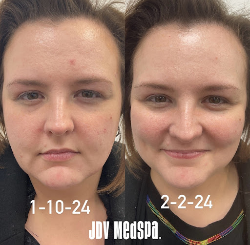 Explore harmonica tattoo ideas, creative tattoo ideas in Canton, available at JDV Med Spa