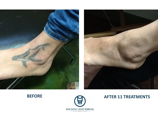 Explore plane tattoo ideas, creative tattoo ideas in San Diego, available at Removery Tattoo Removal & Fading