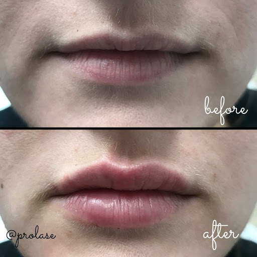 Explore 3 heart tattoo ideas, creative tattoo ideas in Glendale, available at Prolase