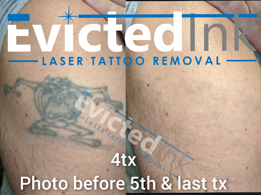 Explore clock tattoo ideas for females, creative tattoo ideas in Wichita, available at Evicted Ink Laser Tattoo Removal