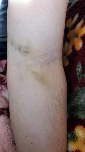 Blood Donation Center «CSL Plasma», reviews and photos