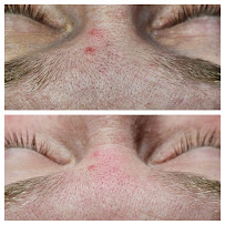 Silky Skin Electrolysis - Photo 6 - Car repair in Dracut, MA, Lowell