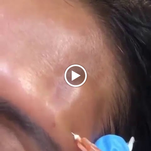 Medical Spa «New Image Medical Spa», reviews and photos, 680 Mowry Ave, Fremont, CA 94536, USA