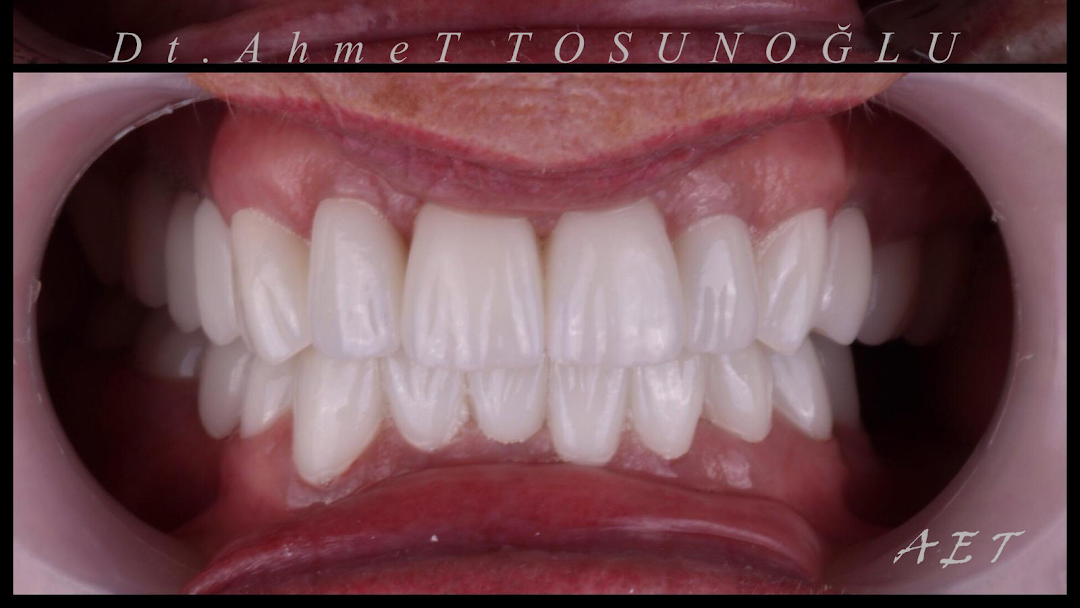 Side ZahnKlinik - Zahnarzt