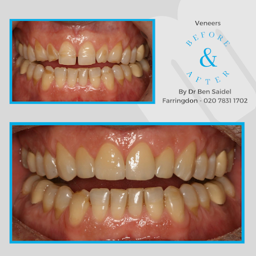 مالمين لطب الأسنان - ليفربول - Malmin Dental - Liverpool