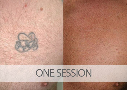 Explore women's first tattoo ideas, creative tattoo ideas in Palm Harbor, available at EradiTatt Tattoo Removal of Palm HarborClearwater
