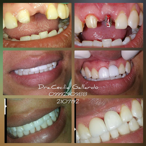 Opiniones de Dra. Cecilia Gallardo Centro De Implantes y Odontológico en Guayaquil - Dentista