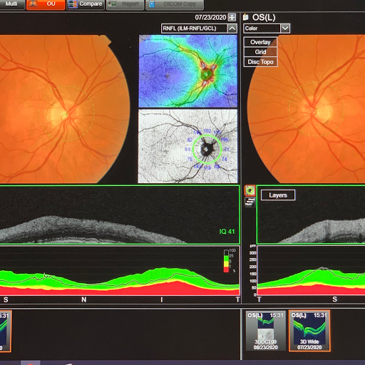 Optometrist «OCEAN OPTICAL», reviews and photos, 16124 NE 87th St, Redmond, WA 98052, USA