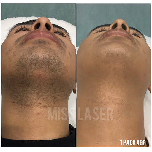 Explore butterfly semicolon tattoo ideas, creative tattoo ideas in Jackson Heights, available at Miss Laser - Laser Hair Removal, Tattoo Removal & Body Contouring