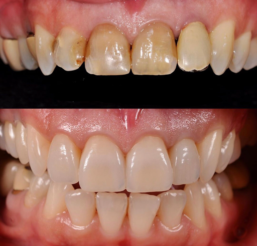 Carlos Garcés DDS - Odontólogo en Bogotá - Implantes Dentales - Cordales
