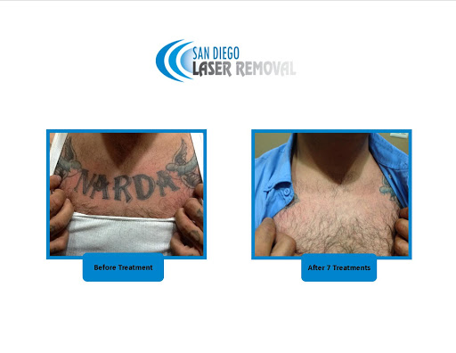 Explore jasmine tattoo ideas, creative tattoo ideas in San Diego, available at Removery Tattoo Removal & Fading