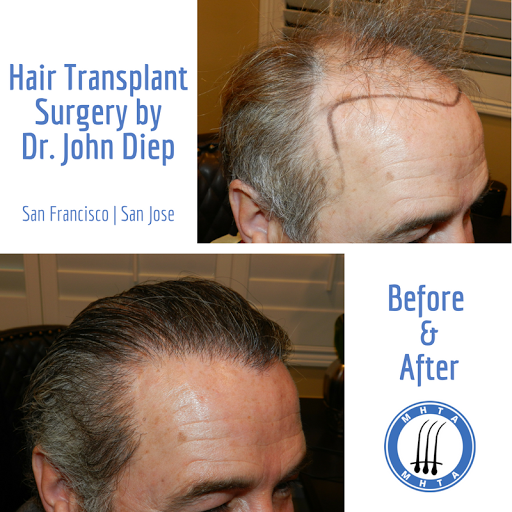 Hair Replacement Service «Medical Hair Transplants & Aesthetics», reviews and photos, 15055 Los Gatos Blvd Suite #110, Los Gatos, CA 95032, USA