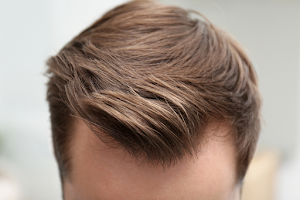 The Crown Clinic | Hair Transplant in Sydney image