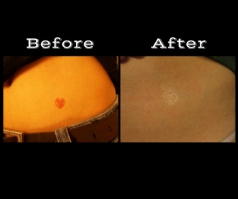 Explore finger tattoo ideas female, creative tattoo ideas in Longview, available at Vanish Laser Aesthetics