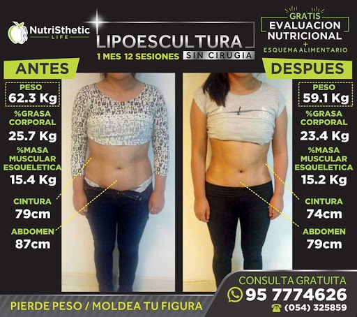 Nutricionistas en Arequipa