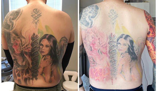 Explore leg tattoo ideas for men black, creative tattoo ideas in Denver, available at Inkless Tattoo Removal