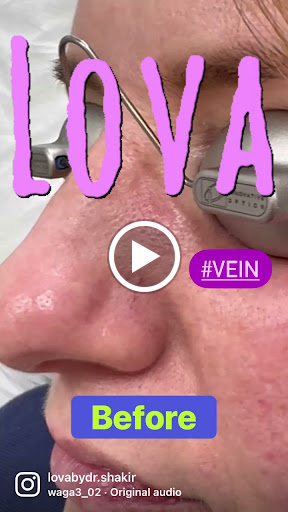 Explore tattoo ideas with meaning for woman, creative tattoo ideas in Lake Oswego, available at Lake Oswego Vein and Aesthetic LOVA