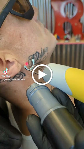 Explore bandana tattoo ideas, creative tattoo ideas in Reno, available at Reno Tattoo Removal