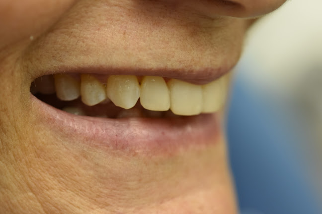 Smile Design Οδοντίατροι Καλαμαριά - Καλαμαριά