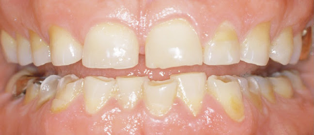 Opiniones de Centro Odontológico de Diagnóstico Integral CODI en Vitacura - Dentista