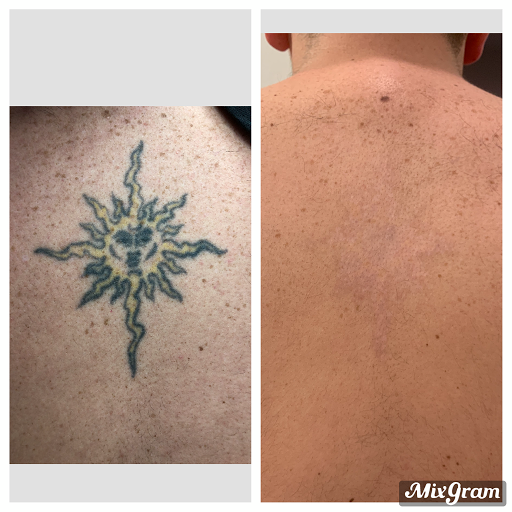 Explore tattoo nature ideas, creative tattoo ideas in Longview, available at Vanish Laser Aesthetics