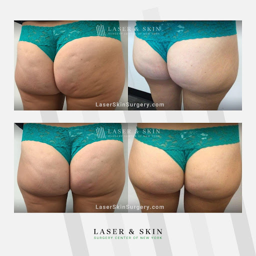 Explore island tattoo ideas, creative tattoo ideas in Southampton, available at Laser & Skin Surgery Center of New York - Southampton