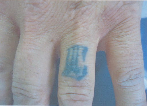 Explore flower tattoo ideas for guys, creative tattoo ideas in Reno, available at Reno Tattoo Removal