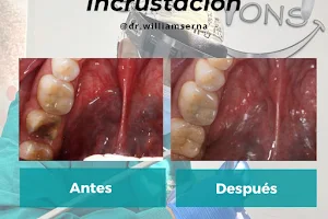 odontología dentals solutions - Implantes Dentales image