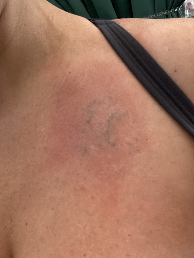 Explore lion and cub tattoo ideas, creative tattoo ideas in Lake Jackson, available at Second Chance Laser Tattoo Removal