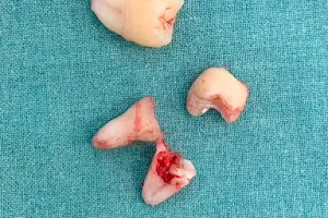 Nha khoa 246 - Cty TNHH Usmile Dental image